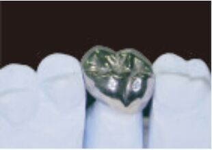 خرید تاج فلزی کامل و پل دقت بالا تاج موقت نقره ای online manufacture