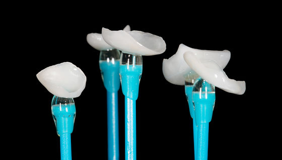 EMAX فشرده شده پوشش دادن Veneer دقت بالا Veneer دندان مناسب است