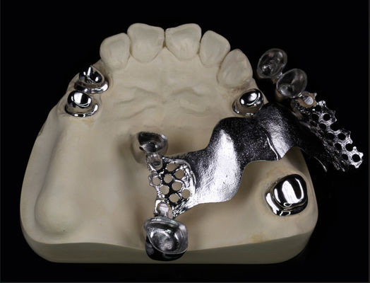 تلسکوپ تاج و پل فلزی برای دندانپزشکی و ارتودنسی